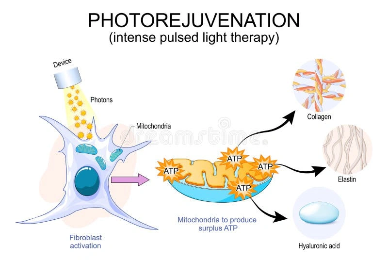 Diagram showing photorejuvenation using light therapy activating mitochondria to produce ATP for collagen, elastin, and hyaluronic acid.