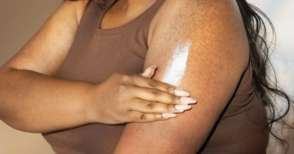 Person applying cream to keratosis pilaris-affected upper arm for smooth, bump-free skin treatment in 2026.