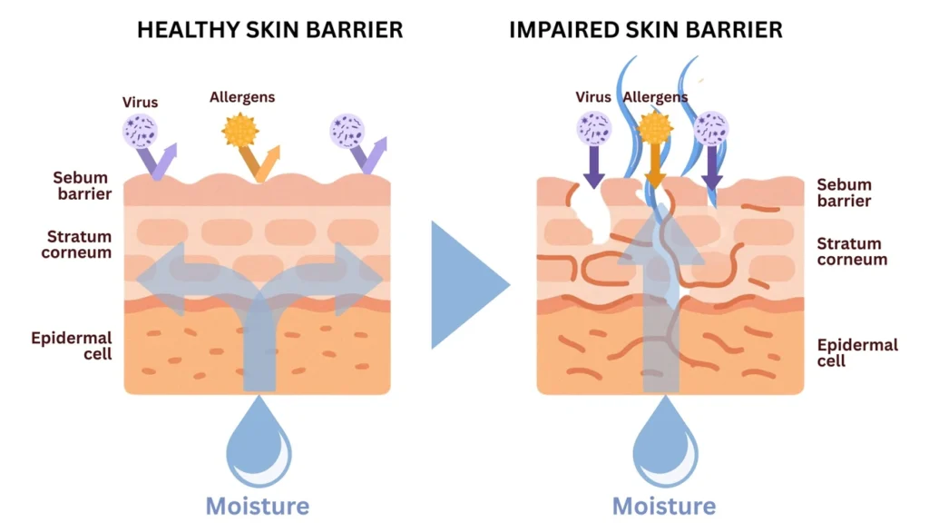 Probiotic Cosmetics: 7 Proven Benefits for a Superior Skin Microbiome 2 Diagram comparing healthy and impaired skin barriers, showing moisture retention and protection from viruses and allergens.